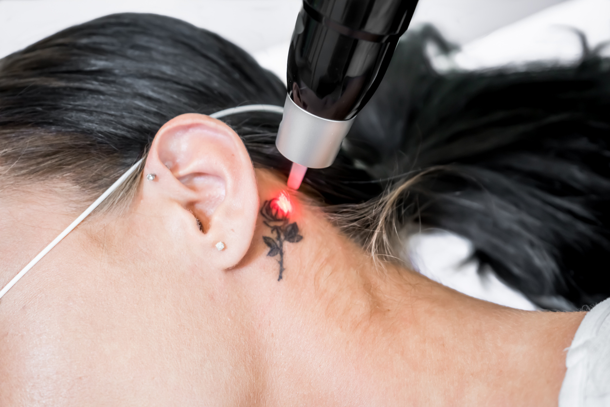 Infection-causing Bacteria Found In Tattoo And Permanent Makeup Inks 